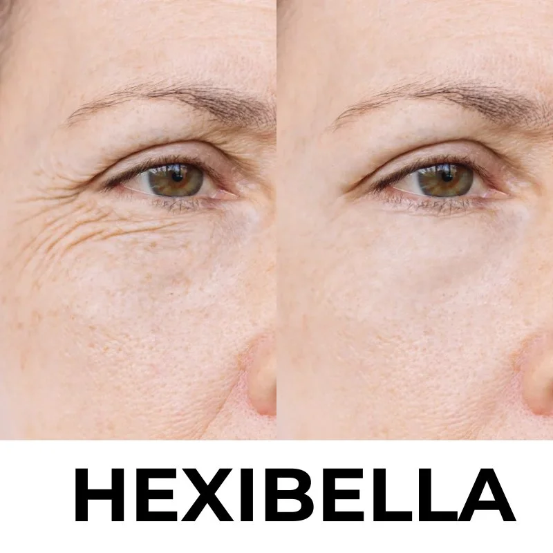 hexibella-001 Hexibella rood licht apparaat