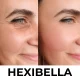 hexibella-002 Hexibella rood licht apparaat