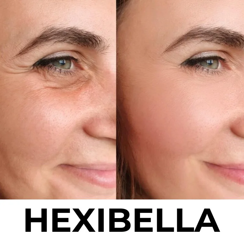 hexibella-002 Hexibella rood licht apparaat