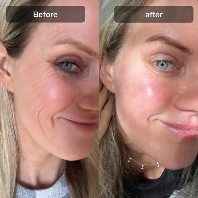 hexibella-014 Hexibella rood licht apparaat