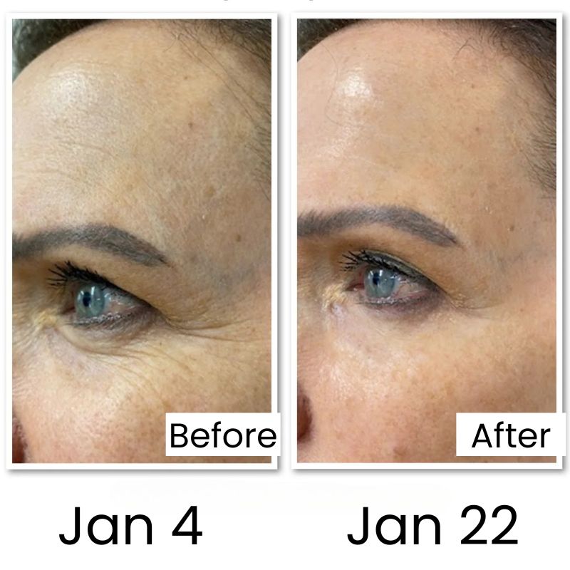 B (7) Snail Mucin Set