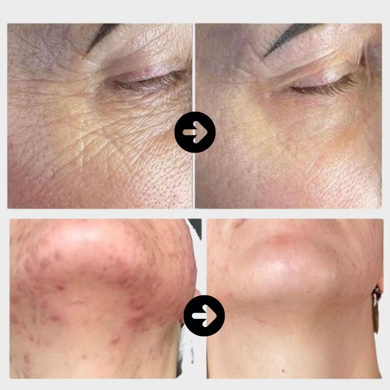 BVSA Snail Mucin Set